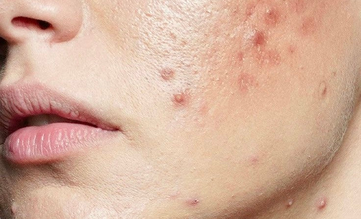 Corrective vs. Maintenance Skincare: The Science of Lasting Beauty