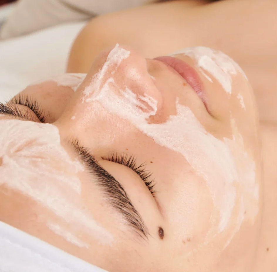 Dermathod O2 Tox Peel Spicule Treatment
