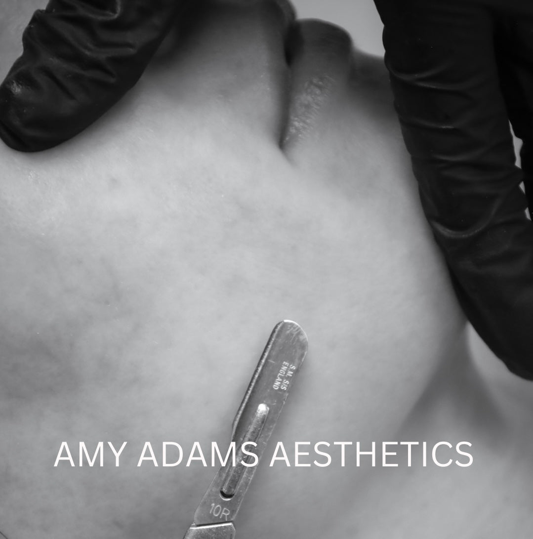 The Glow Secret: Why Dermaplaning Is the Ultimate Skin Smoother