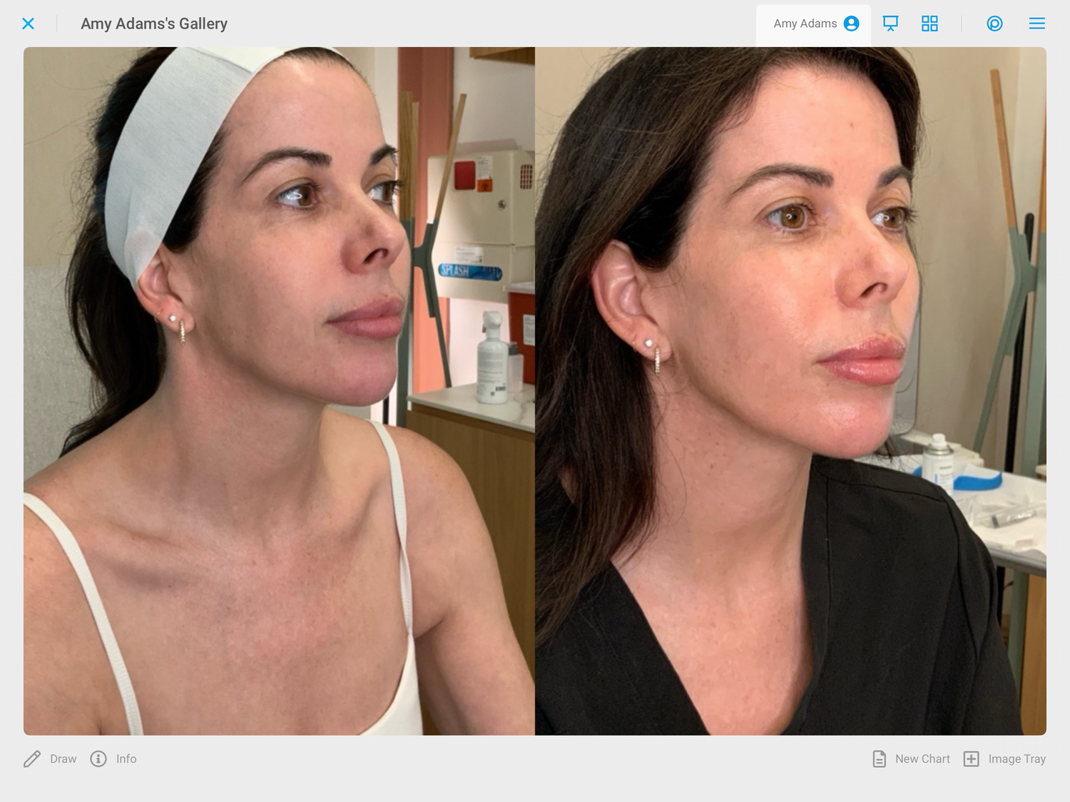 Q2 Round Up: How I Maintain Healthy, Radiant Skin with Aesthetic Treatments